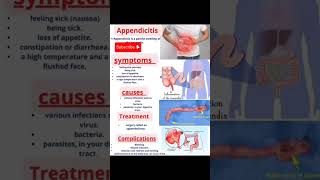 Appendicitis hospital nursing injection science humananatomy [upl. by Uzzial511]