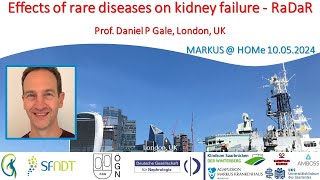 Effects of rare diseases on kidney failure  RaDaR  Prof Dr Daniel P Gale London UK [upl. by Alodie84]