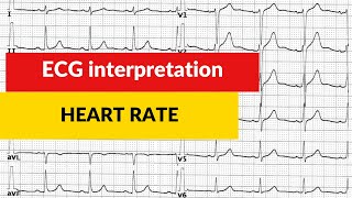 ECG interpretation Heart rate calculation [upl. by Lorusso]