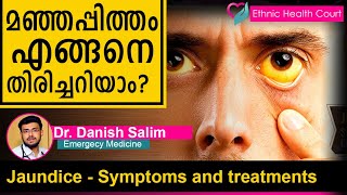 Jaundice  Symptoms and treatments  മഞ്ഞപ്പിത്തം എങ്ങനെ തിരിച്ചറിയാം  Ethnic Health Court [upl. by Whitby]