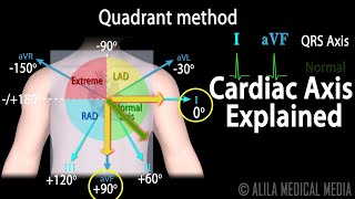 Cardiac Axis Interpretation Animation [upl. by Aretta]