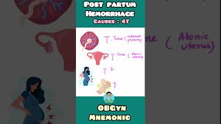 Post Partum Hemorrhage causes explained with easy mnemonic for USMLE NEET PG NCLEX INICET [upl. by Ynohtnad]