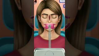 Broken nose surgery  mengoperasi hidung [upl. by Nimar]