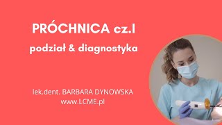 PRÓCHNICA ZĘBÓW  diagnostyka podział objawy jak leczyć [upl. by Ulla638]