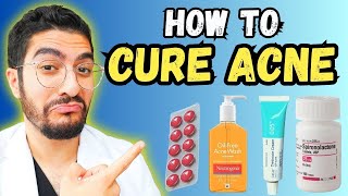 99 Overlook These Effective Acne Treatments – 2024 Guide [upl. by Roderic]