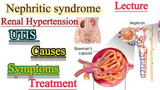 Nephritic syndromeUrinary Tract infectionsRenal Hypertensioncauses SymptomsTreatment [upl. by Doro]