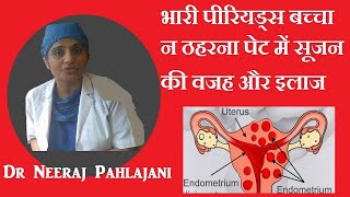 पेट में सूजन पीरियड्स में दर्द बच्चा न ठहरना का इलाज Bulky Uterus Adenomyosis [upl. by Babette853]