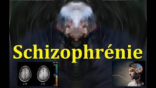 Schizophrénie les symptômes et la physiopathologie explication neurobiologique [upl. by Rafe]