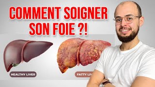 Comment soigner le FOIE GRAS Stéatose hépatique [upl. by Seward]