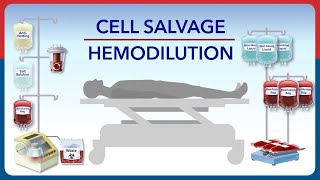 Cell Salvage and Hemodilution [upl. by Carmelia823]