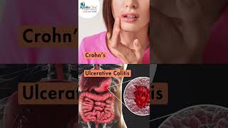 Understanding Inflammatory Bowel Disease Part 1  Apollo Clinic Chinar Park viralreels [upl. by Hsenid500]