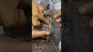 Medical college dissection hall human cadaver liver😱 ytshorts shorts shortvideo viralshorts [upl. by Curt]