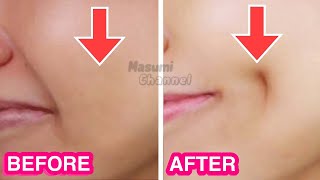 How To Get Dimples Fast amp Naturally Simple Facial Exercises to get Dimples without Surgery [upl. by Noby]