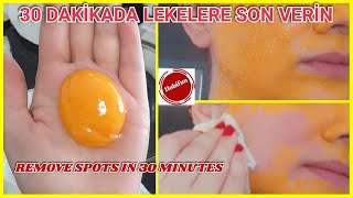 YUMURTA SARISI İLE 30 DAKİKADA LEKELERİ YOK ET  CİLT BEYAZLATICI DOĞAL MASKE [upl. by Devol]