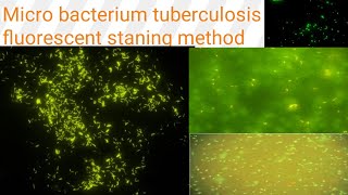 AuramineRhodamine staining on fluorescent microscopy Diagnosis of TB Microbacterium tuberculosis [upl. by Tegdig797]