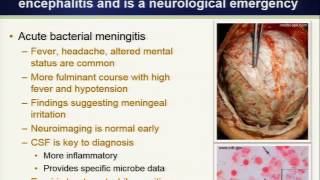 clinical approach to encephalitis [upl. by Borg]