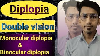 Diplopia Double vision difference between monocular amp binocular diplopia [upl. by Lluj]