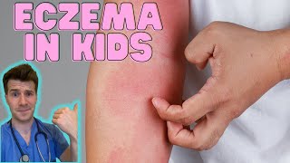 Everything you need to know about Eczema in kids Causes symptoms treatment amp home management [upl. by Paucker]