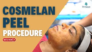 Cosmelan Peel Treatment  All about Cosmelan Peel  Antiageing Treatment Delhi  SkinQure [upl. by Nwahsit258]