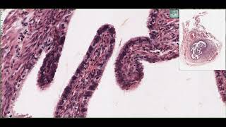 Histology of the Oviduct Fallopian Tubes 4K [upl. by Nayarb]