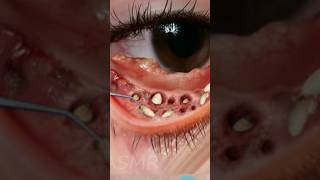 ASMR Remove Fake Eyelashes amp Dog Ticks infected Eyes Animation shorts ytshorts youtubeshorts [upl. by Firooc388]