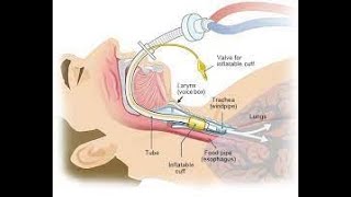 Principles of Airway Management and Ventilation [upl. by Adnohr522]