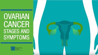 Understanding Ovarian Cancer Stages and Symptoms [upl. by Kirsch]