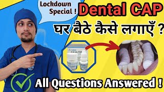 Dental Cap Fixing at home कैसे करे  LOCKDOWN Special Tooth Cap Fitting All Answers by Dr Pathak [upl. by Esirahs838]