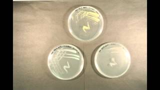 Bacterial Growth time lapse [upl. by Itram]