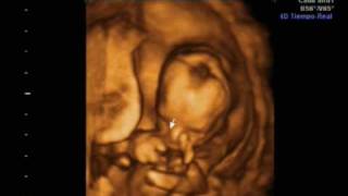 Ecografia 16 semanas 4D y 2D Ultrasound Irati [upl. by Sherline]