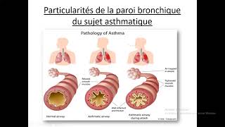 14Asthme Dr Djali BEO  Pneumo [upl. by Porta]