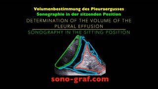 Sonographie  Volumenbestimmung des Pleuraergusses [upl. by Eiroc286]