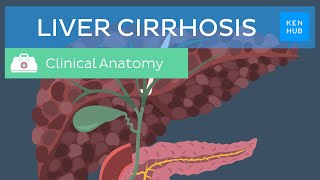 Liver cirrhosis Definition pathology diagnosis treatment and prevention  Kenhub [upl. by Mou920]