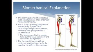 Mobilization to correct an Anterior Innominate rotation of the pelvis Physical Therapy [upl. by Renat]