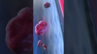 Pulmonary Embolism 3d animationPhysiology of pulmonary embolismshorts viralshortvideo [upl. by Asena]