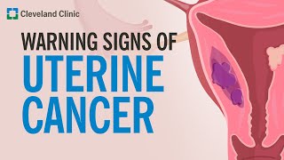 The Most Common Warning Sign of Uterine Cancer [upl. by Nezah500]