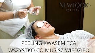 Peeling kwasem TCA  wskazania przebieg i efekty peelingu chemicznego [upl. by Alin87]