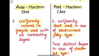 Antemortem Clot vs Postmortem Clot mbbs forensic neetpg forensicscience [upl. by Georgiana776]