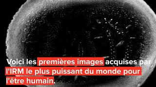 Première mondiale L’IRM le plus puissant au monde livre ses premières images [upl. by Jordan470]