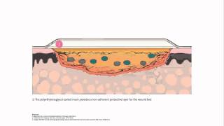 INADINE™ Povidone Iodine NonAdherent Dressing  Mode of action [upl. by Socem]