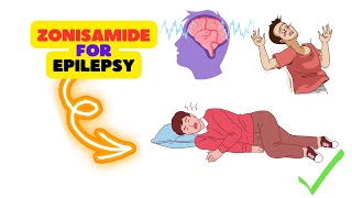 Zonisamide Review Understanding the Benefits and Potential Side Effects in Epilepsy Management [upl. by Hays]