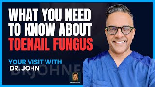 What You Need to Know About Toenail Fungus [upl. by Ajssatsan995]