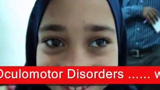 Intermittent Exotropia  الحول الوحشي المتقطع [upl. by Imogene900]