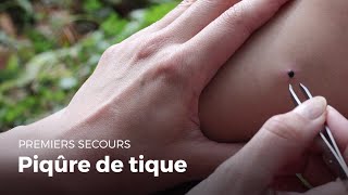 Premiers secours  Piqure de tique  Secourisme [upl. by Stochmal]