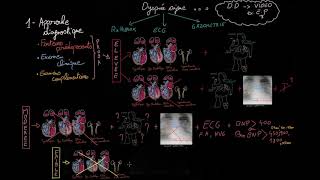 Insuffisance cardiaque aiguë en 3 étapes  Partie 1  Docteur Synapse [upl. by Eimmit594]