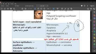 L25 Pathology Salivary Gland Tumors 1 [upl. by Odinevneib]