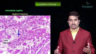 Morphology of Reversible cell injury  General Pathology Animated Lecture Dr Bhanu prakash [upl. by Ainat]