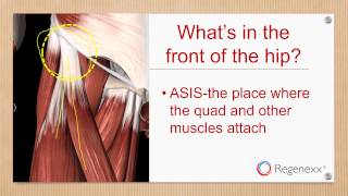 Pain in the Front of the Hip  Causes and Treatments Available [upl. by Ayotas]