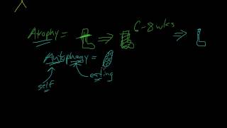 3  Introduction to Pathology  Atrophy Metaplasia [upl. by Torto]