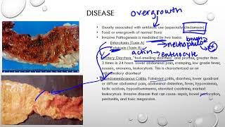 New Clostridioides difficile C diff treatment guidelines made easy [upl. by Esialb567]